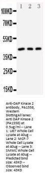 Anti-DAP Kinase 2/DAPK2 Antibody Picoband®