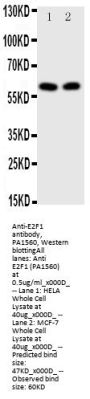 Anti-Transcription factor E2F1 E2F1 Antibody Picoband®