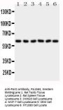 Anti-PAK1 Antibody Picoband®