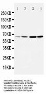 Anti-Dopamine Receptor D1/DRD1 Antibody Picoband®