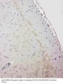 Anti-GABA A Receptor alpha 1/GABRA1 Antibody Picoband®