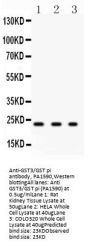 Anti-GST3/GST pi/GSTP1 Antibody Picoband®