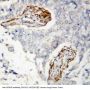 Anti-Histone deacetylase 8 HDAC8 Antibody Picoband®