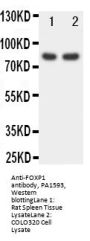 Anti-Forkhead box protein P1 FOXP1 Antibody Picoband®