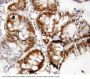 Anti-Forkhead box protein P1 FOXP1 Antibody Picoband®