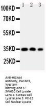 Anti-Homeobox protein Hox-A4 HOXA4 Antibody Picoband®