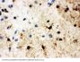 Anti-Heat shock factor protein 2 HSF2 Antibody Picoband®
