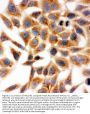 Anti-HSD17B1 Antibody Picoband®