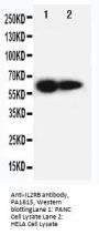 Anti-IL2 Receptor beta/IL2RB Antibody Picoband®