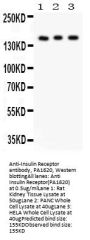 Anti-Insulin Receptor/INSR Antibody Picoband®