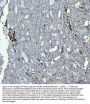 Anti-Integrin beta 3/ITGB3 Antibody Picoband®