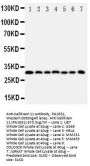Anti-Kallikrein 11/KLK11 Antibody Picoband®