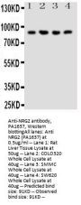 Anti-NRG2 Antibody Picoband®