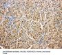 Anti-Kallistatin/SERPINA4 Antibody Picoband®