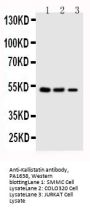 Anti-Kallistatin/SERPINA4 Antibody Picoband®