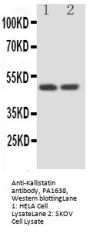 Anti-Kallistatin/SERPINA4 Antibody Picoband®
