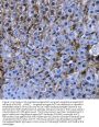 Anti-Angiotensinogen/AGT Antibody Picoband®