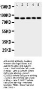 Anti-5 Lipoxygenase/ALOX5 Antibody Picoband®