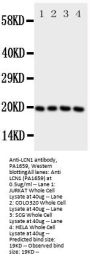 Anti-Lipocalin-1 LCN1 Antibody Picoband®