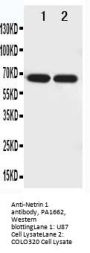 Anti-Netrin 1/NTN1 Antibody Picoband®