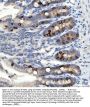 Anti-NADPH oxidase 1 NOX1 Antibody Picoband®