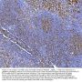 Anti-NOX2/gp91phox/CYBB Antibody Picoband®