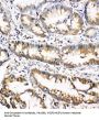 Anti-Oncostatin M/OSM Antibody Picoband®
