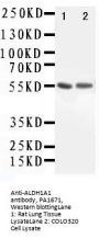 Anti-Retinal dehydrogenase 1 ALDH1A1 Antibody Picoband®