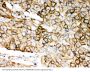 Anti-Retinal dehydrogenase 1 ALDH1A1 Antibody Picoband®