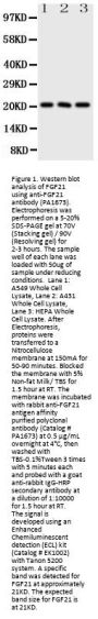 Anti-Fibroblast growth factor 21 FGF21 Antibody Picoband®