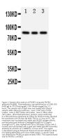 Anti-PI 3 Kinase p85 beta/PIK3R2 Antibody Picoband®