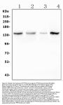 Anti-Myosin Phosphatase/PPP1R12A Antibody Picoband®