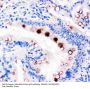 Anti-Estrogen Inducible Protein pS2/TFF1 Antibody Picoband®