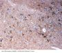 Anti-Tenascin-R TNR Antibody Picoband®