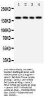 Anti-Tenascin-R TNR Antibody Picoband®