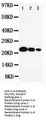 Anti-Interleukin-6 IL6 Antibody Picoband®