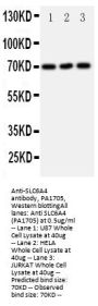 Anti-Serotonin transporter/SLC6A4 Antibody Picoband®