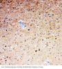 Anti-Serotonin transporter/SLC6A4 Antibody Picoband®