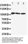 Anti-SERCA1 ATPase/ATP2A1 Antibody Picoband®