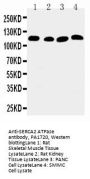 Anti-SERCA2 ATPase/ATP2A2 Antibody Picoband®