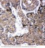 Anti-ABCB6 Antibody Picoband®