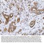 Anti-COX2/Cyclooxygenase 2/PTGS2 Antibody Picoband®