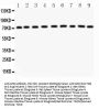 Anti-Growth hormone receptor/GHR Antibody Picoband®