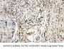 Anti-NADPH oxidase 1 NOX1 Antibody Picoband®