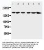 Anti-ALK Antibody Picoband®
