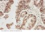 Anti-ALK Antibody Picoband®