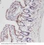 Anti-ALK Antibody Picoband®
