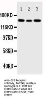 Anti-IGF1 Receptor/IGF1R Antibody Picoband®