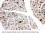 Anti-IGF1 Receptor/IGF1R Antibody Picoband®