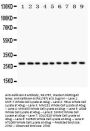 Anti-Kallikrein 6/KLK6 Antibody Picoband®